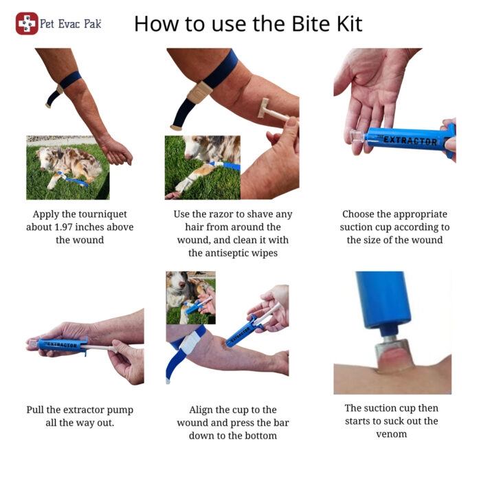 Bite Kit How to use